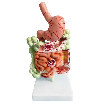 Модел на човешката храносмилателна система Анатомия на стомаха Дебело черво Cecum Rectum Duodenum Човешки вътрешни органи Структура Модел